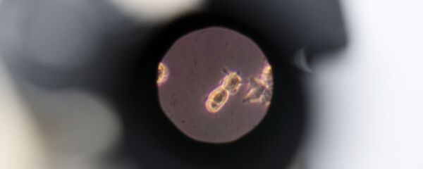 Образец биоматерилала под микроскопом  Образец биоматерилала под микроскопом  - Sputnik Южная Осетия