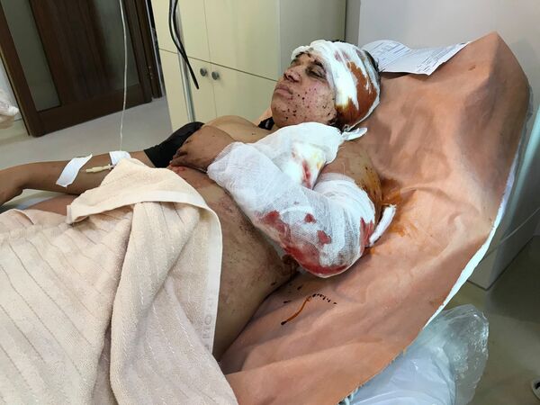 Раненное гражданское население в больницах Карабаха - Sputnik Южная Осетия