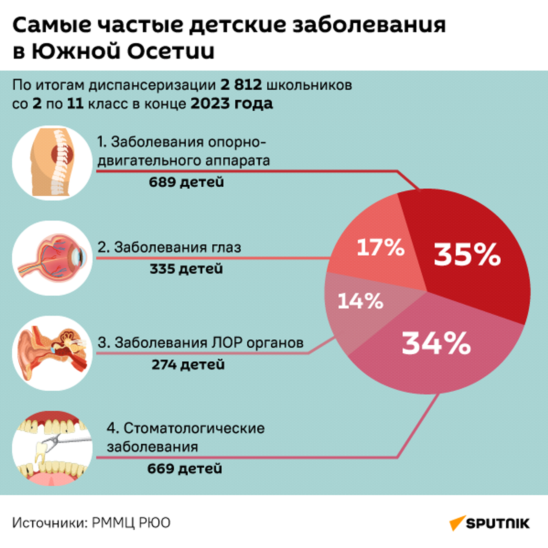 Самые частые детские заболевания в Южной Осетии - Sputnik Южная Осетия, 1920, 21.11.2025