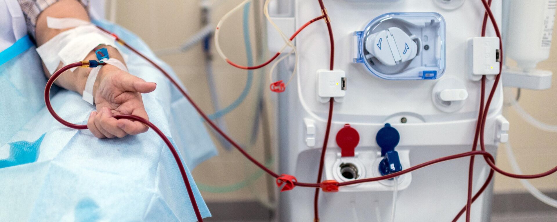 Пациент во время процедуры очистки крови на аппарате Искусственная почка - Sputnik Южная Осетия, 1920, 28.02.2026