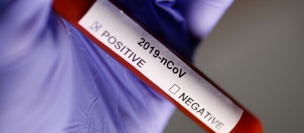 Тест на коронавирус Тест на коронавирус - Sputnik Южная Осетия