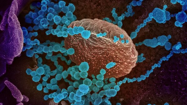 Вид на зараженную коронавирусом  клетку под микроскопом  - Sputnik Южная Осетия