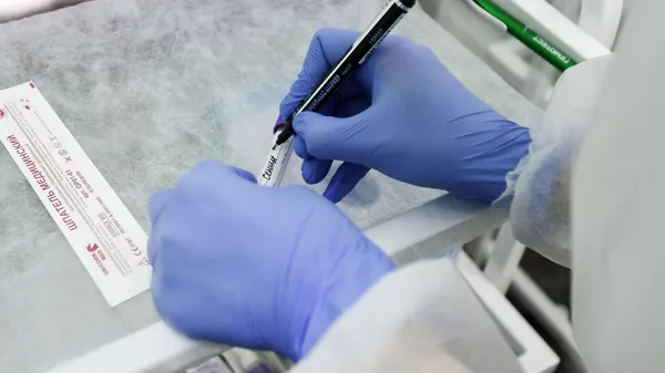 Лаборатория Гемотест начинает делать тесты на COVID-19 в Симферополе