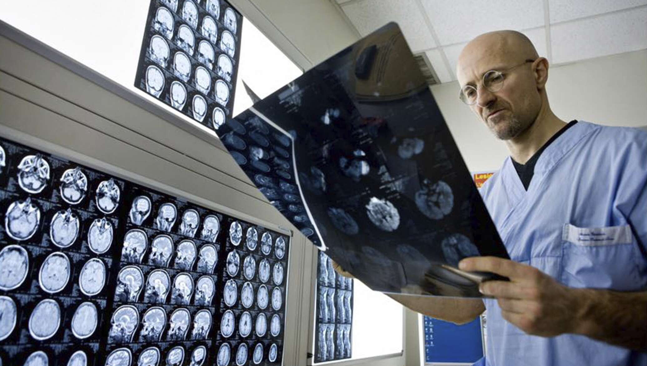 Пересадка клеток мозга. Серджио Канаверо голова человека. Итальянский нейрохирург Серджио Канаверо. Серджио Канаверо пересадка. Серджио Канаверо пересадка головы.