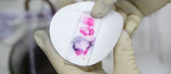 Контроль качества мяса Контроль качества мяса - Sputnik Южная Осетия