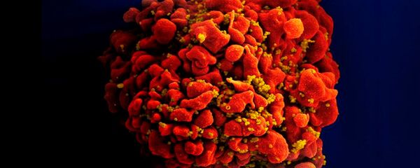 ВИЧ - Sputnik Южная Осетия