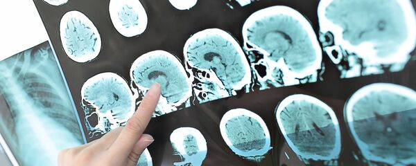 Снимок компьютерной томографии человеческой головы - Sputnik Южная Осетия