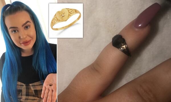 Чихнула кольцом: из носа британки выпало пропавшее на 12 лет украшение Чихнула кольцом: из носа британки выпало пропавшее на 12 лет украшение - Sputnik Южная Осетия