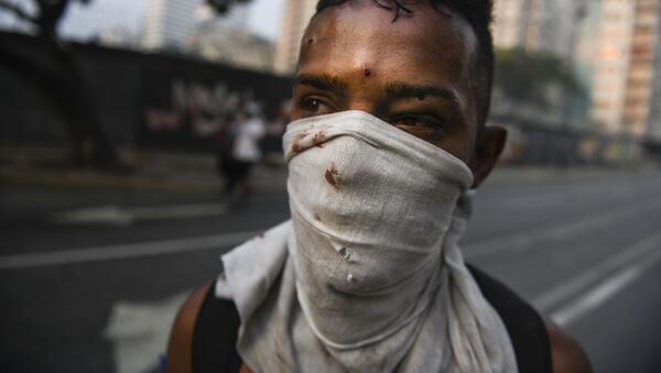 Протестующий, раненный в столкновениях с Национальной гвардией Венесуэлы в Альтамире, районе Каракаса - Sputnik Южная Осетия