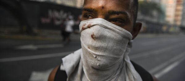Протестующий, раненный в столкновениях с Национальной гвардией Венесуэлы в Альтамире, районе Каракаса Протестующий, раненный в столкновениях с Национальной гвардией Венесуэлы в Альтамире, районе Каракаса - Sputnik Южная Осетия