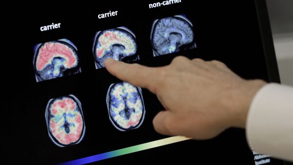 Доктор Уильям Берк осматривает сканирование мозга ПЭТ в Баннерном институте Альцгеймера в Фениксе. - Sputnik Южная Осетия