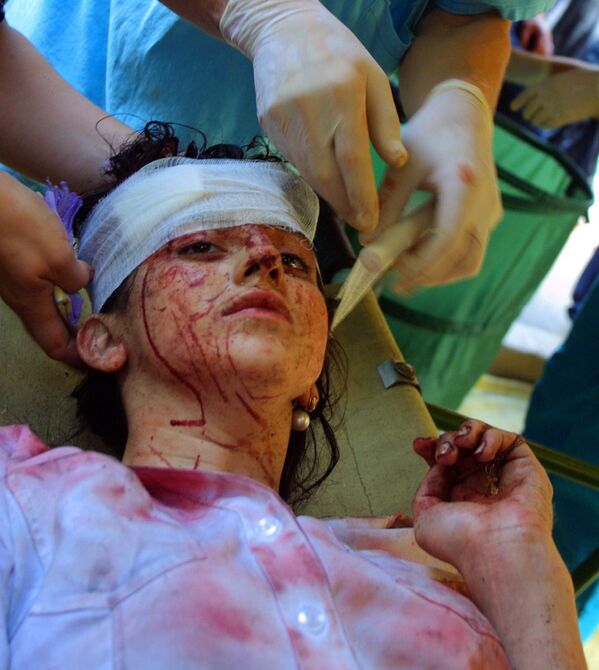 Раненая 14-летняя Виктория Кцоева. 3 сентября 2004 года. - Sputnik Южная Осетия